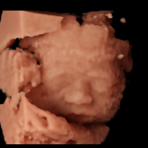 ecografia-maternidad-ourense
