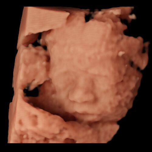 maternidad-ourense-ecografia