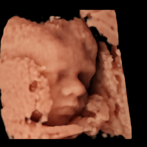 ourense-ecografia-embarazo